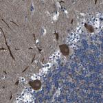 GRAMD1A Antibody in Immunohistochemistry (Paraffin) (IHC (P))
