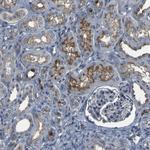 GRAMD1A Antibody in Immunohistochemistry (Paraffin) (IHC (P))