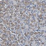 GRAMD1A Antibody in Immunohistochemistry (Paraffin) (IHC (P))