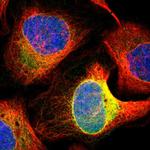 FDFT1 Polyclonal Antibody