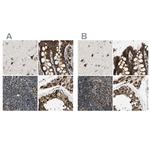 ME2 Polyclonal Antibody