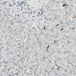 ME2 Antibody in Immunohistochemistry (IHC)