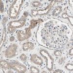 SNX29 Polyclonal Antibody