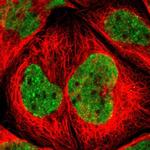 CHAMP1 Polyclonal Antibody