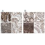 CHAMP1 Antibody in Immunohistochemistry (IHC)