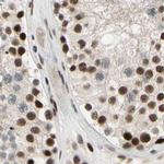 CHAMP1 Antibody in Immunohistochemistry (IHC)