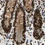 CHAMP1 Antibody in Immunohistochemistry (IHC)