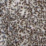 CHAMP1 Antibody in Immunohistochemistry (IHC)