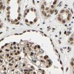CHAMP1 Antibody in Immunohistochemistry (IHC)