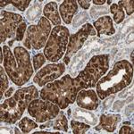 URB2 Antibody in Immunohistochemistry (Paraffin) (IHC (P))