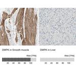 DMPK Antibody