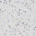 COTL1 Antibody in Immunohistochemistry (Paraffin) (IHC (P))