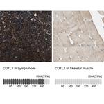 COTL1 Antibody in Immunohistochemistry (IHC)