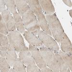 COTL1 Antibody in Immunohistochemistry (IHC)