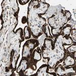 FNDC3A Antibody in Immunohistochemistry (Paraffin) (IHC (P))