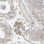 FNDC3A Antibody in Immunohistochemistry (Paraffin) (IHC (P))