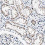 p27 Polyclonal Antibody