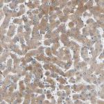 p27 Antibody in Immunohistochemistry (Paraffin) (IHC (P))