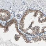 p27 Antibody in Immunohistochemistry (Paraffin) (IHC (P))