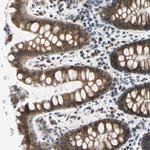 p27 Antibody in Immunohistochemistry (Paraffin) (IHC (P))