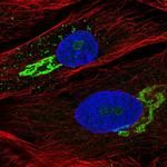 GALNT5 Polyclonal Antibody