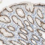 GALNT5 Antibody in Immunohistochemistry (Paraffin) (IHC (P))