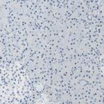 B4GALNT1 Polyclonal Antibody