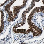 SLC27A6 Antibody in Immunohistochemistry (Paraffin) (IHC (P))