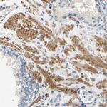 SLC27A6 Antibody in Immunohistochemistry (Paraffin) (IHC (P))