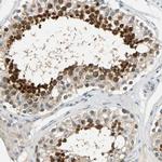 CCDC104 Polyclonal Antibody