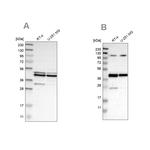CCDC104 Antibody in Western Blot (WB)