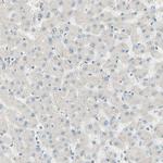 JPH1 Antibody in Immunohistochemistry (Paraffin) (IHC (P))