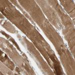 JPH1 Antibody in Immunohistochemistry (Paraffin) (IHC (P))