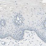 JPH1 Antibody in Immunohistochemistry (Paraffin) (IHC (P))