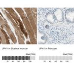 JPH1 Antibody in Immunohistochemistry (IHC)