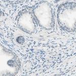 JPH1 Antibody in Immunohistochemistry (IHC)