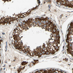 FAM213A Antibody in Immunohistochemistry (Paraffin) (IHC (P))