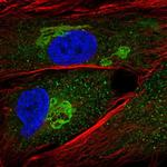 GALNT5 Polyclonal Antibody