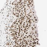 ZNF134 Antibody in Immunohistochemistry (Paraffin) (IHC (P))