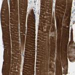 TPM3 Polyclonal Antibody