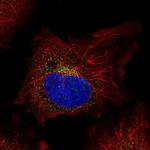 SPINK5 Antibody in Immunocytochemistry (ICC/IF)