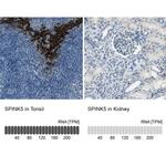 SPINK5 Antibody in Immunohistochemistry (IHC)