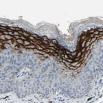 SPINK5 Antibody in Immunohistochemistry (IHC)