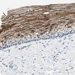 SPINK5 Antibody in Immunohistochemistry (IHC)