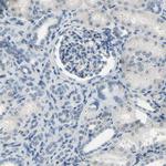SPINK5 Antibody in Immunohistochemistry (IHC)