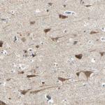 AATK Polyclonal Antibody