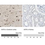 AATK Antibody in Immunohistochemistry (IHC)