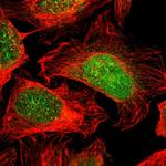 FAM49B Polyclonal Antibody