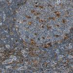 FAM49B Antibody in Immunohistochemistry (Paraffin) (IHC (P))