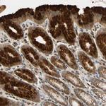 TMEM230 Antibody in Immunohistochemistry (Paraffin) (IHC (P))